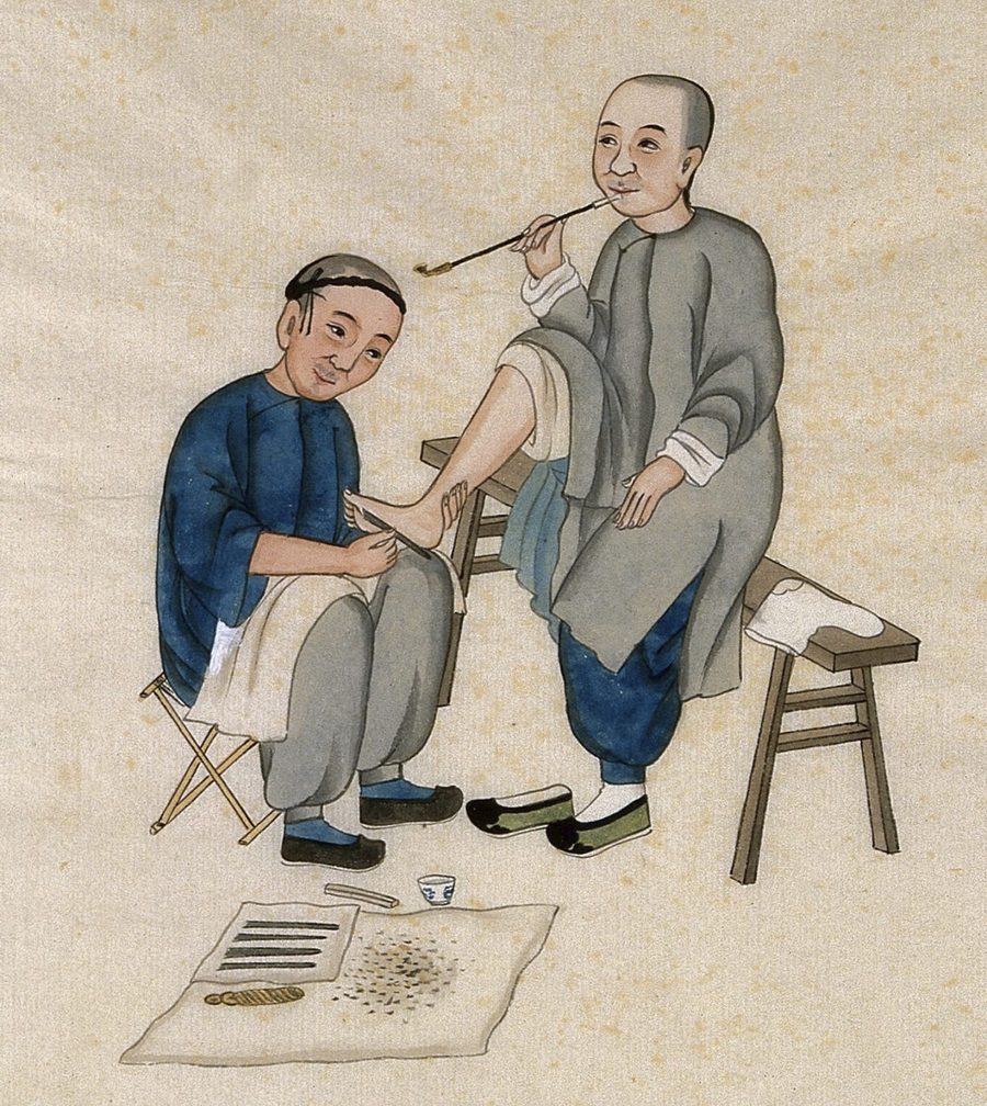 Peinture chinoise ancienne : un praticien soigne le pied d'un homme assis sur un banc